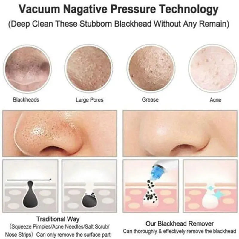 Blackhead Remover Instrument