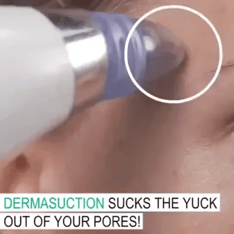 Blackhead Remover Instrument