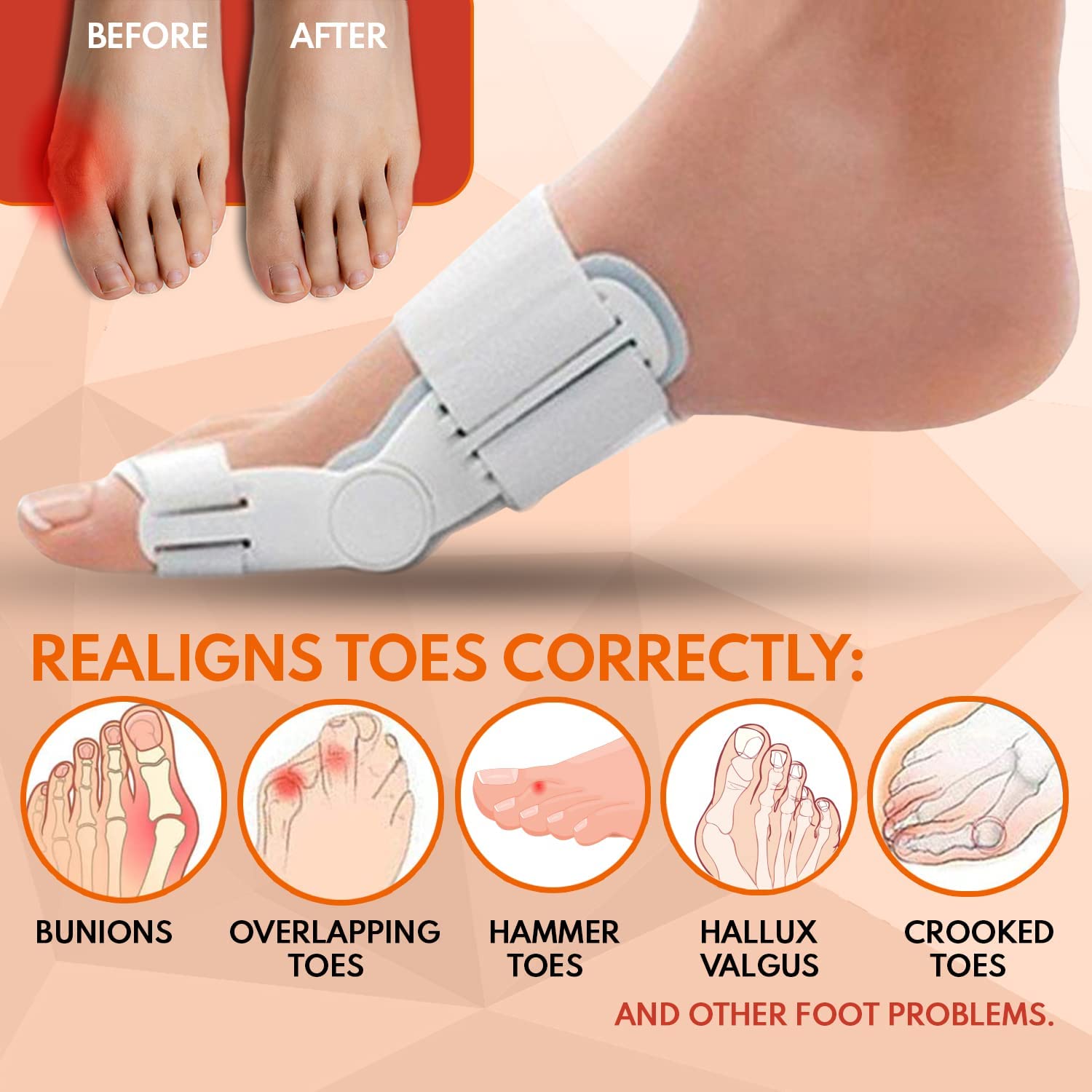 Bunion Corrector