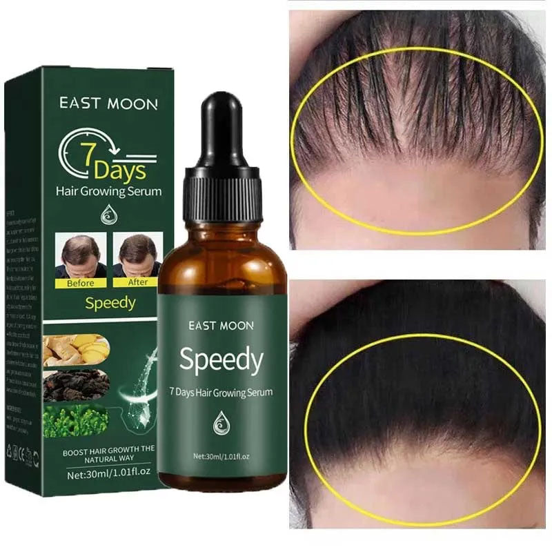 7 Days Hair Grow Serum