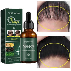 7 Days Hair Grow Serum