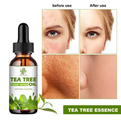 Pure Tea Tree Hydrating Oil